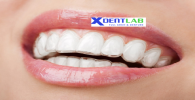 introduce Clear aligner dental labs