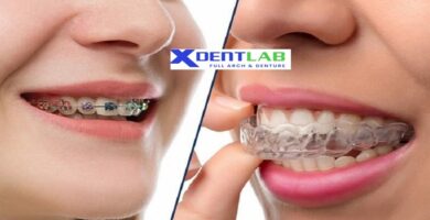 introduce Global orthodontic outsourcing services