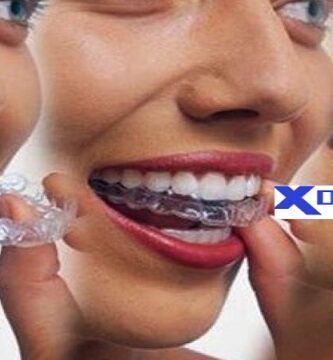 Worldwide clear aligner contract production