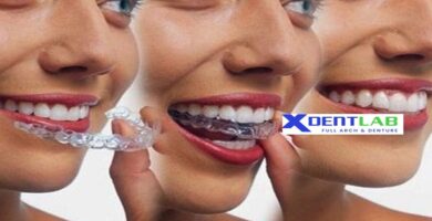 Worldwide clear aligner contract production