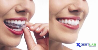 Clear aligner contract manufacturing