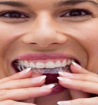 Clear aligner supplier