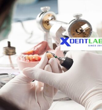 introduce Vietnam's Dental Laboratories