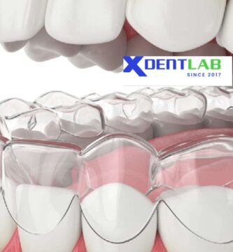 Worldwide bulk clear aligner supplier