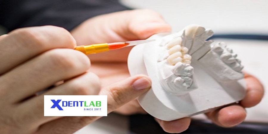 Dental Labs in vietnam District 8 Ho Chi Minh