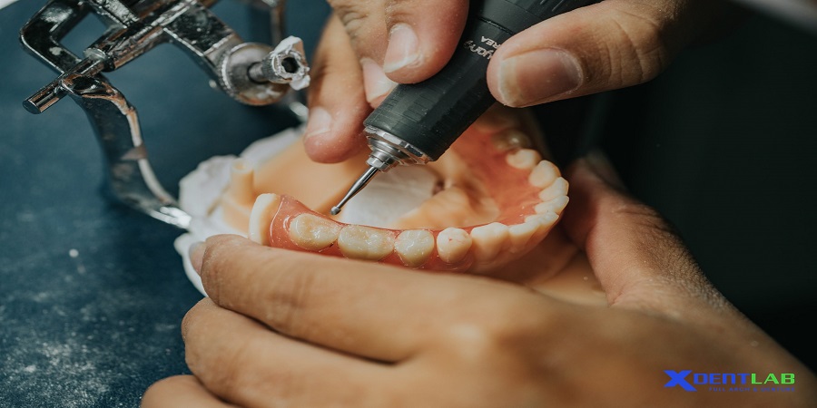 Dental lab vietnam District Tan Binh Ho Chi Minh