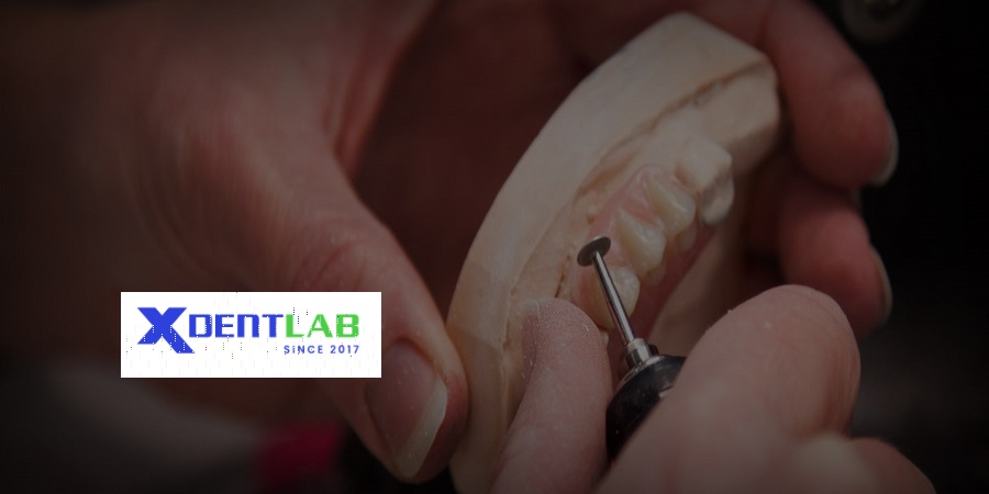 Vietnam dental laboratory Thu Duc District Ho Chi Minh
