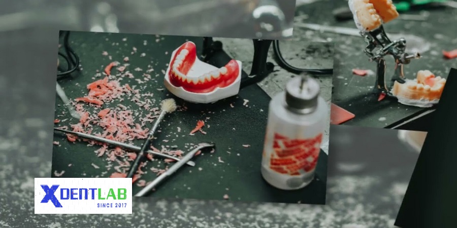 Dental lab in vietnam District 6 Ho Chi Minh City