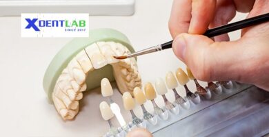 Vietnam dental laboratories district 8 Ho Chi Minh